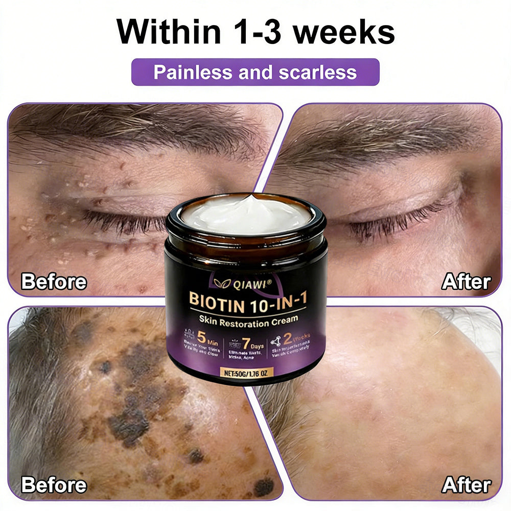 🔥LAST DAY 50% OFF - QIAWI® Biotin 10-in-1 Skin Restoration Cream