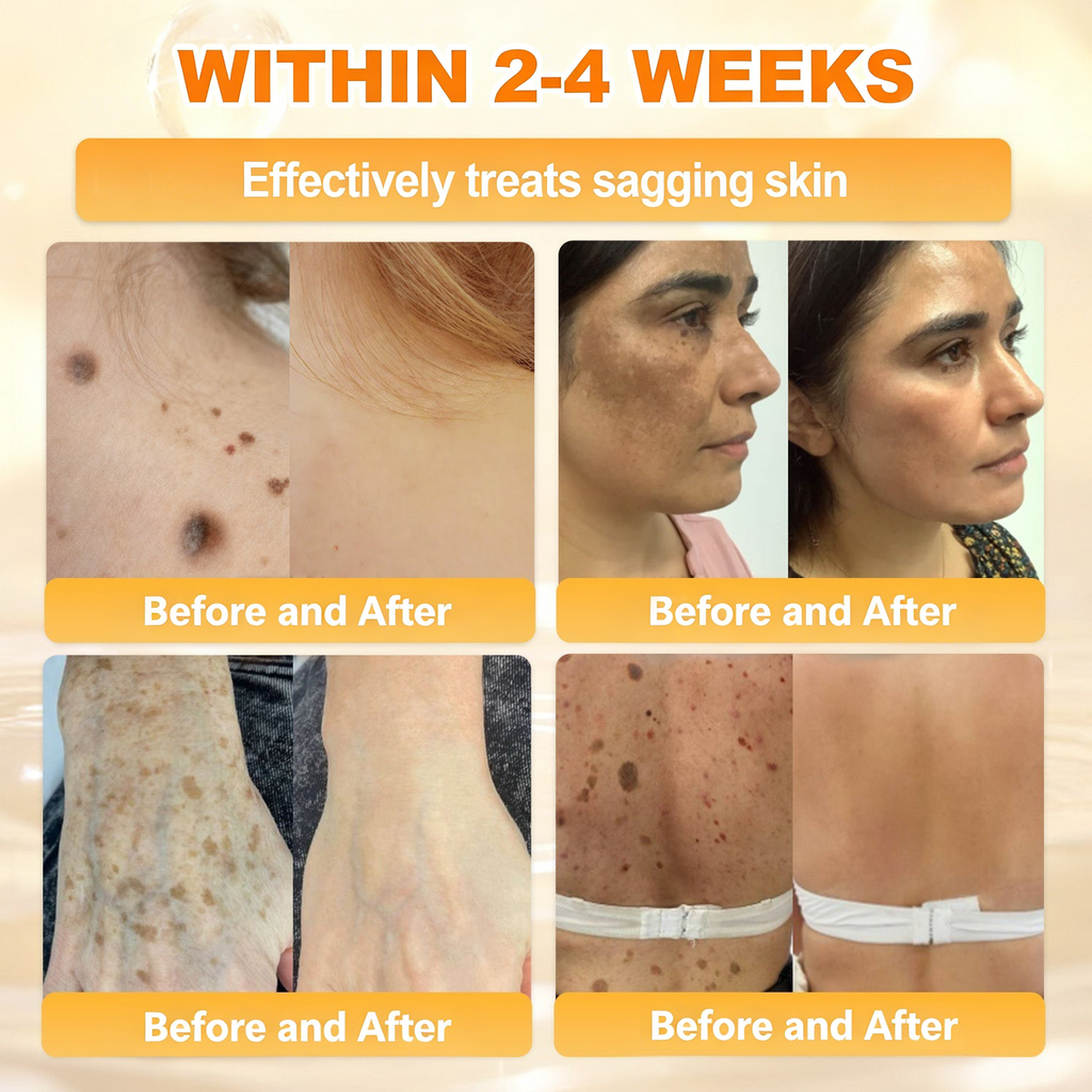 𝐋𝐎𝐕𝐈𝐋𝐃𝐒™ 𝐁𝐞𝐞 𝐏𝐨𝐢𝐬𝐨𝐧 𝐀𝐥𝐥-𝐢𝐧-𝐎𝐧𝐞 𝐂𝐫𝐞𝐚𝐦–🌸 Anti-aging,Hydrating, Skin Repair, Even Tone, Acne and Dark Spot Treatment, Wart and Mole Removal, Psoriasis Relief