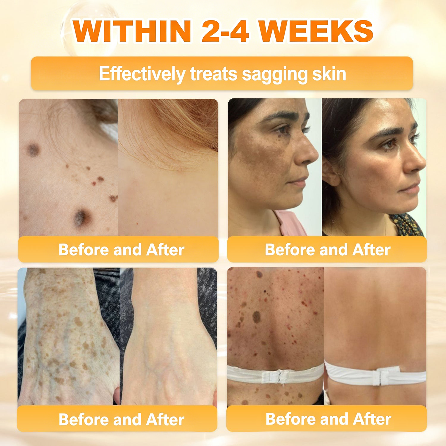 𝐋𝐎𝐕𝐈𝐋𝐃𝐒™ 𝐁𝐞𝐞 𝐏𝐨𝐢𝐬𝐨𝐧 𝐀𝐥𝐥-𝐢𝐧-𝐎𝐧𝐞 𝐂𝐫𝐞𝐚𝐦–🌸 Anti-aging,Hydrating, Skin Repair, Even Tone, Acne and Dark Spot Treatment, Wart and Mole Removal, Psoriasis Relief