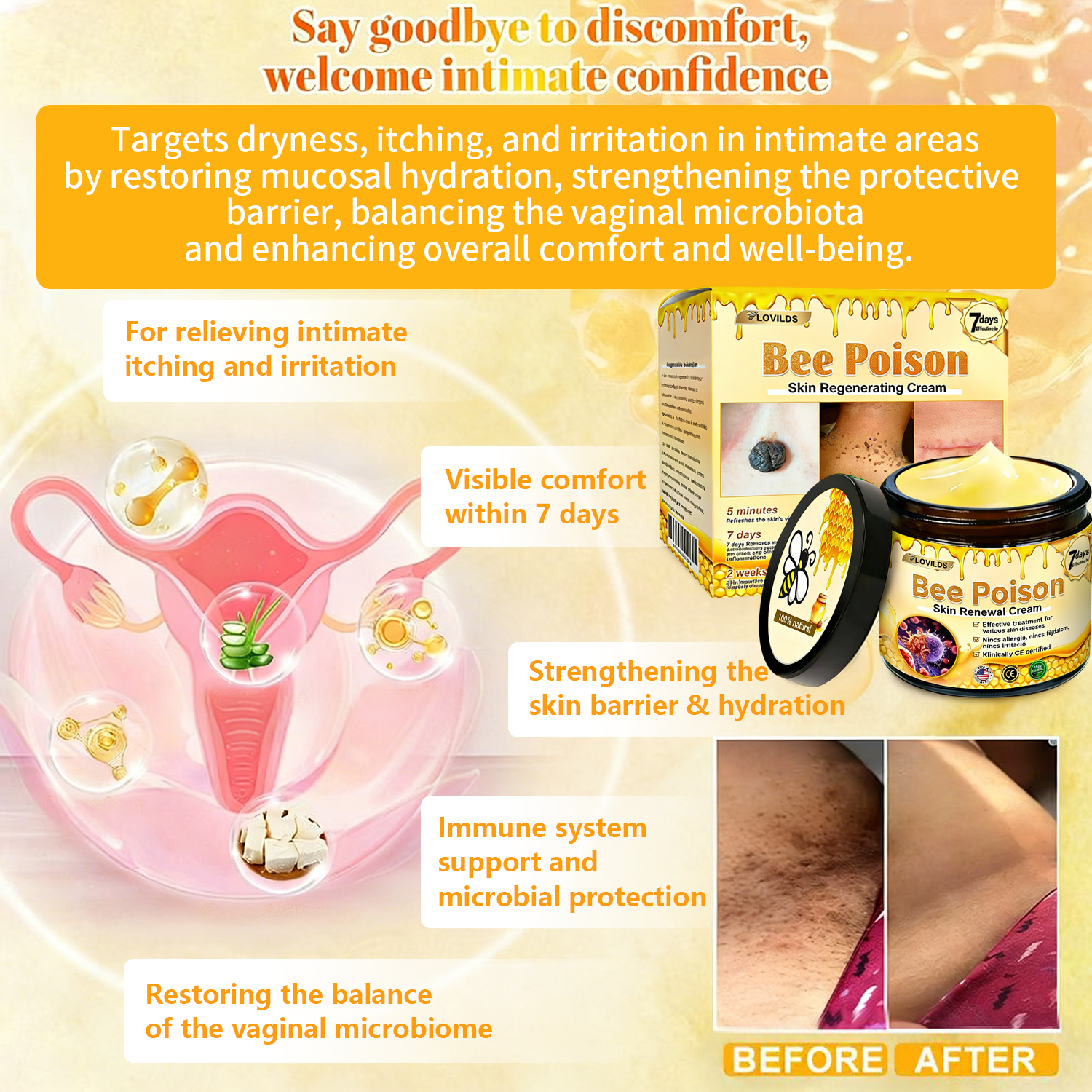 𝐋𝐎𝐕𝐈𝐋𝐃𝐒™ 𝐁𝐞𝐞 𝐏𝐨𝐢𝐬𝐨𝐧 𝐀𝐥𝐥-𝐢𝐧-𝐎𝐧𝐞 𝐂𝐫𝐞𝐚𝐦–🌸 Anti-aging,Hydrating, Skin Repair, Even Tone, Acne and Dark Spot Treatment, Wart and Mole Removal, Psoriasis Relief