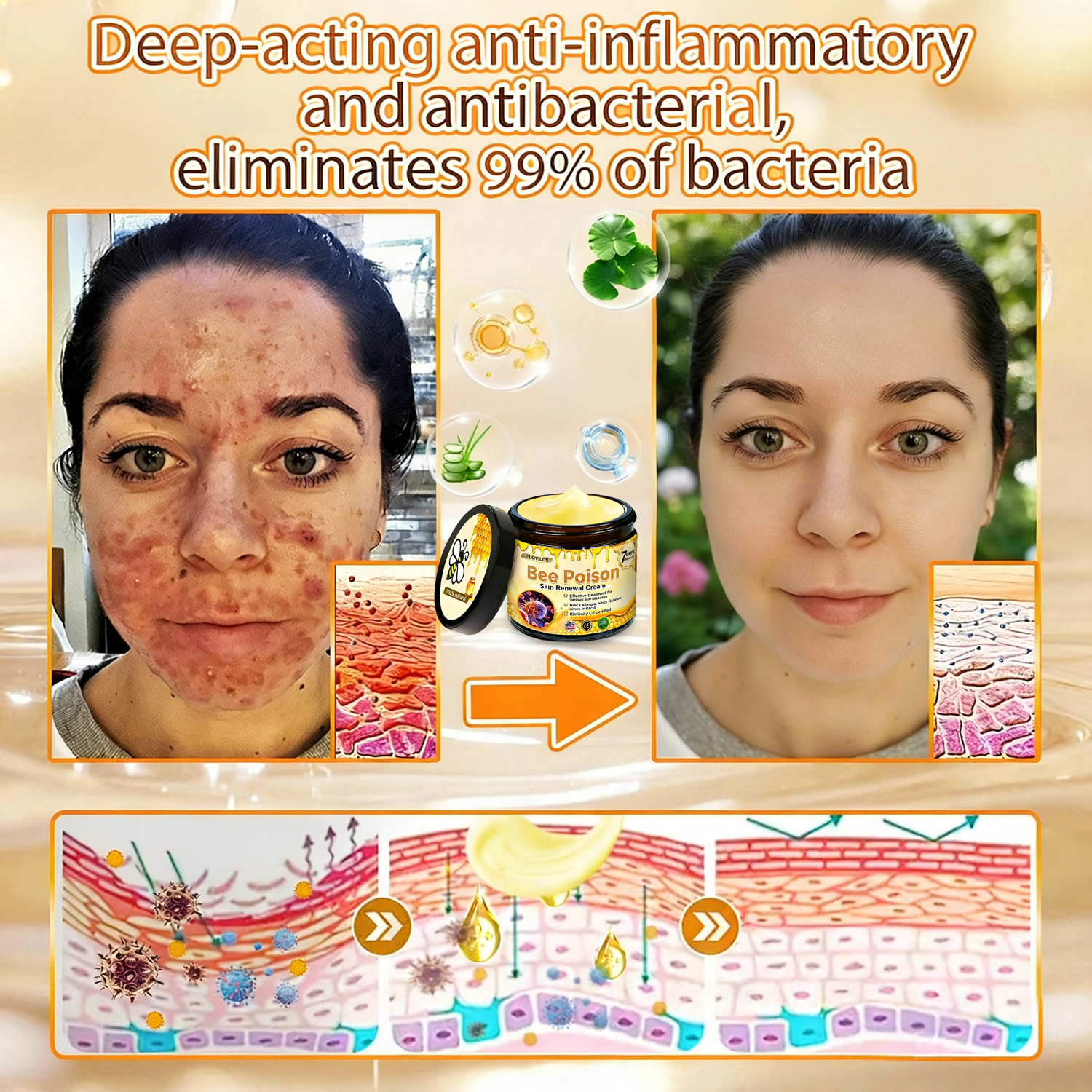 𝐋𝐎𝐕𝐈𝐋𝐃𝐒™ 𝐁𝐞𝐞 𝐏𝐨𝐢𝐬𝐨𝐧 𝐀𝐥𝐥-𝐢𝐧-𝐎𝐧𝐞 𝐂𝐫𝐞𝐚𝐦–🌸 Anti-aging,Hydrating, Skin Repair, Even Tone, Acne and Dark Spot Treatment, Wart and Mole Removal, Psoriasis Relief