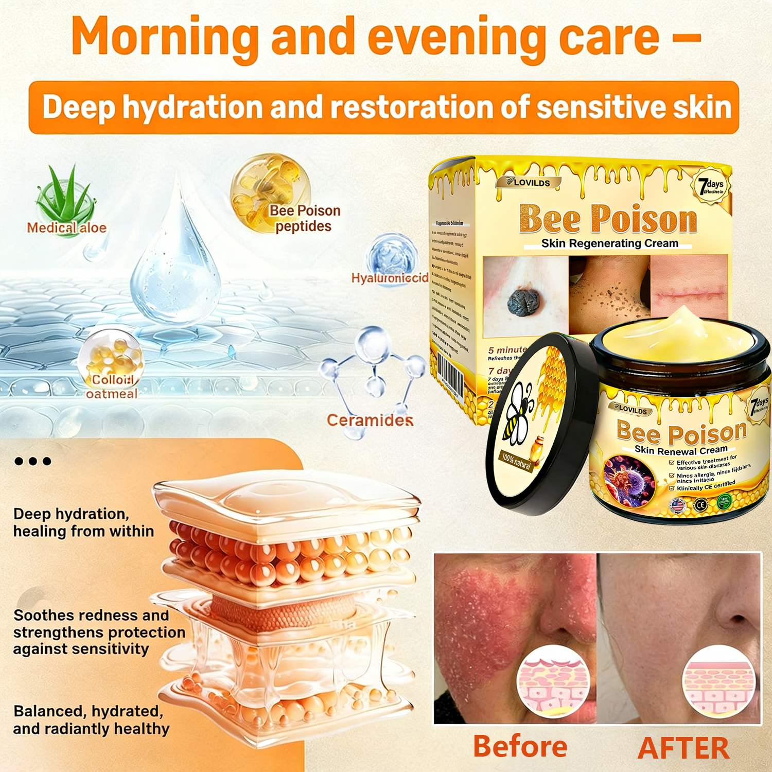 𝐋𝐎𝐕𝐈𝐋𝐃𝐒™ 𝐁𝐞𝐞 𝐏𝐨𝐢𝐬𝐨𝐧 𝐀𝐥𝐥-𝐢𝐧-𝐎𝐧𝐞 𝐂𝐫𝐞𝐚𝐦–🌸 Anti-aging,Hydrating, Skin Repair, Even Tone, Acne and Dark Spot Treatment, Wart and Mole Removal, Psoriasis Relief