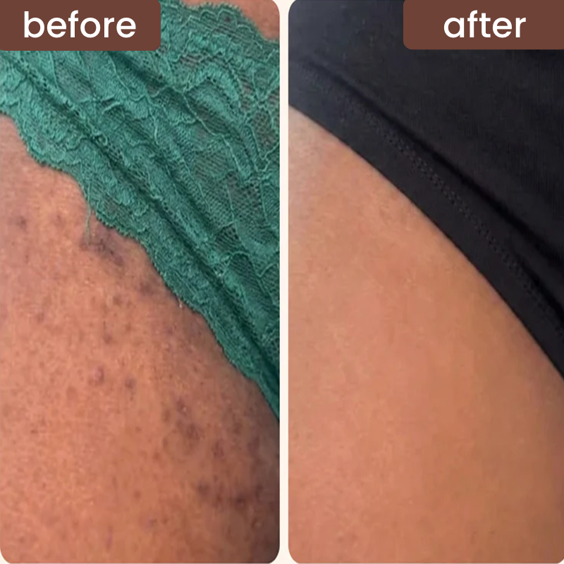 3-in-1 Bikini Line Care Serum