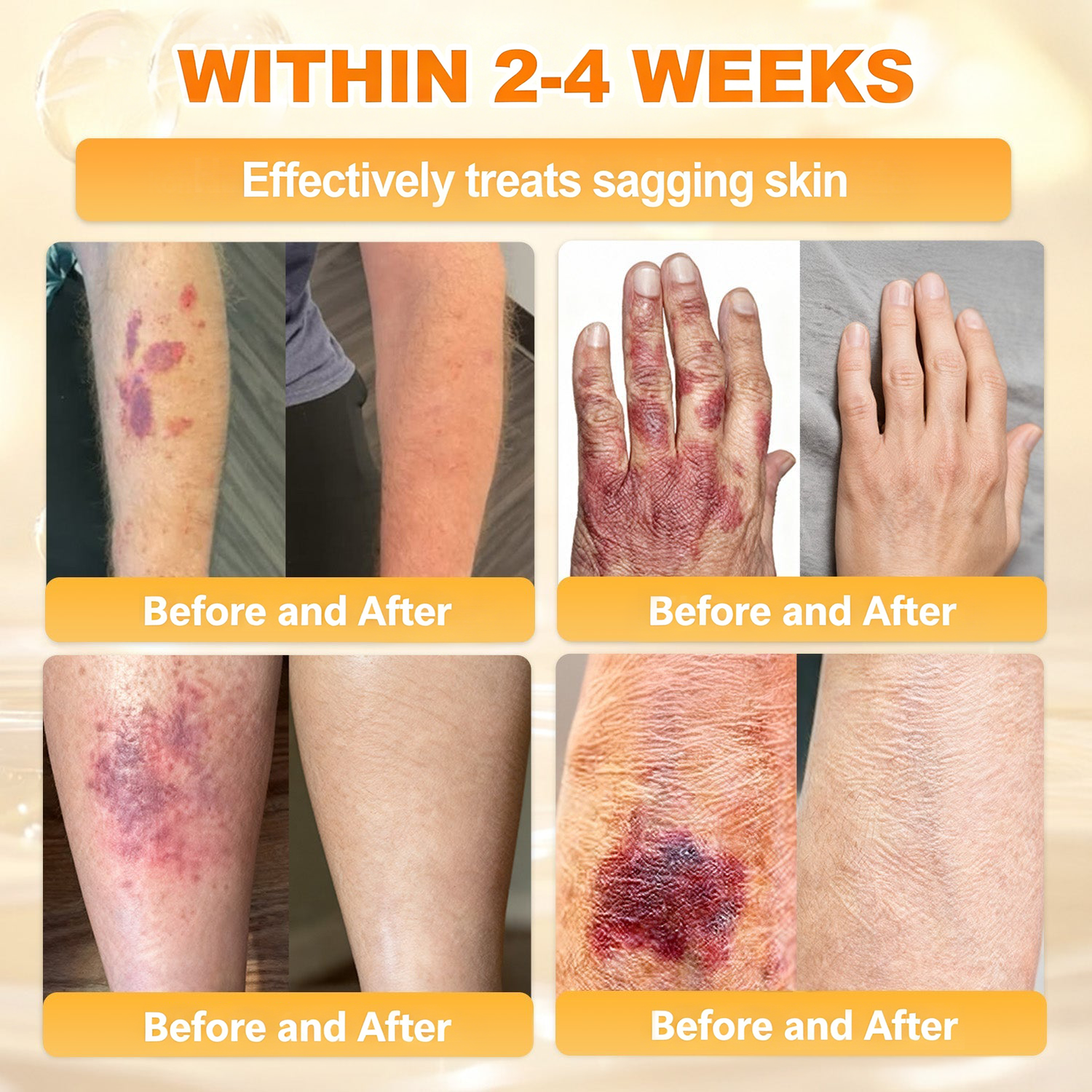 𝐋𝐎𝐕𝐈𝐋𝐃𝐒™ 𝐁𝐞𝐞 𝐏𝐨𝐢𝐬𝐨𝐧 𝐀𝐥𝐥-𝐢𝐧-𝐎𝐧𝐞 𝐂𝐫𝐞𝐚𝐦–🌸 Anti-aging,Hydrating, Skin Repair, Even Tone, Acne and Dark Spot Treatment, Wart and Mole Removal, Psoriasis Relief