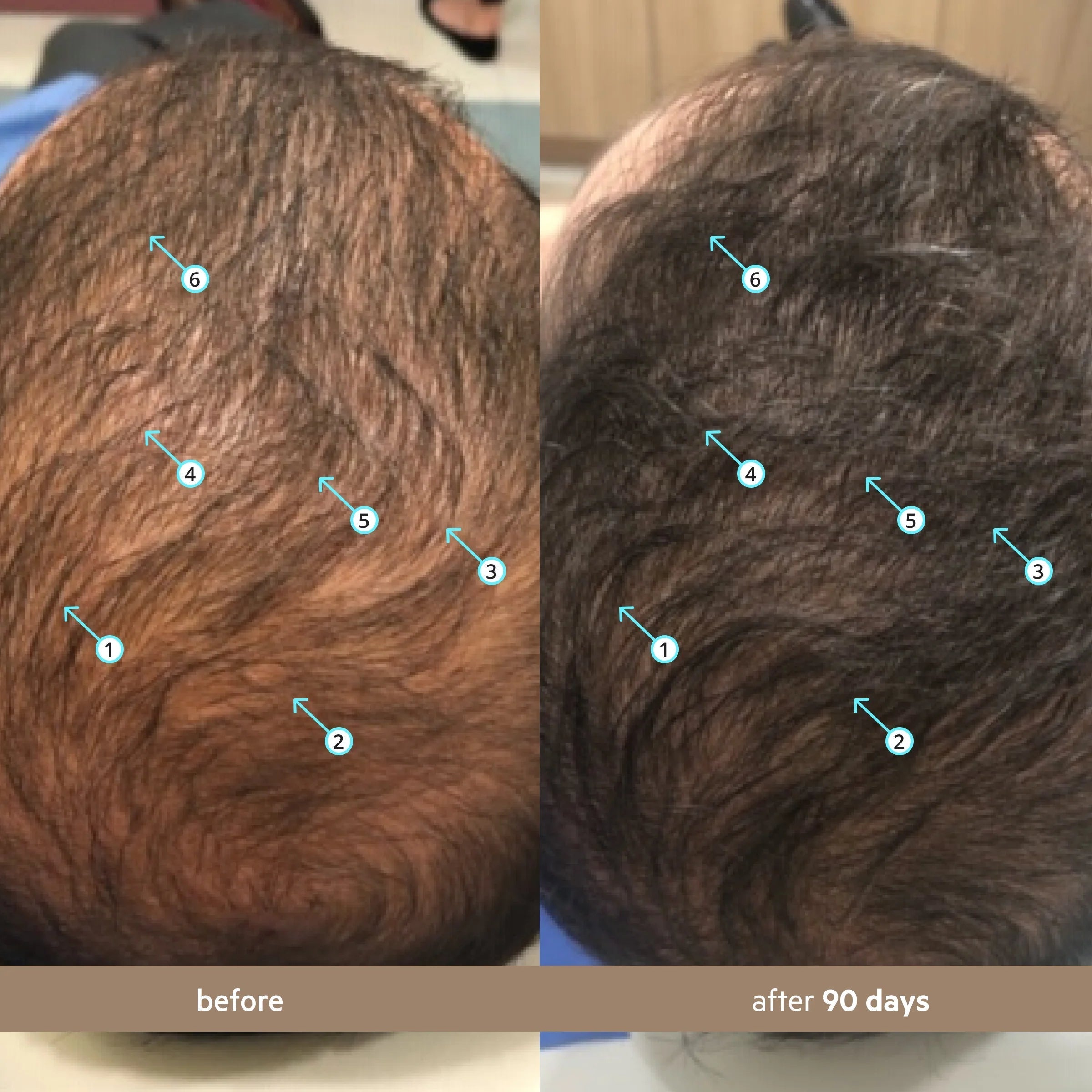 Spectral Men’s Nanoxidil 5% Hair Growth Serum for Thicker, Fuller Hair