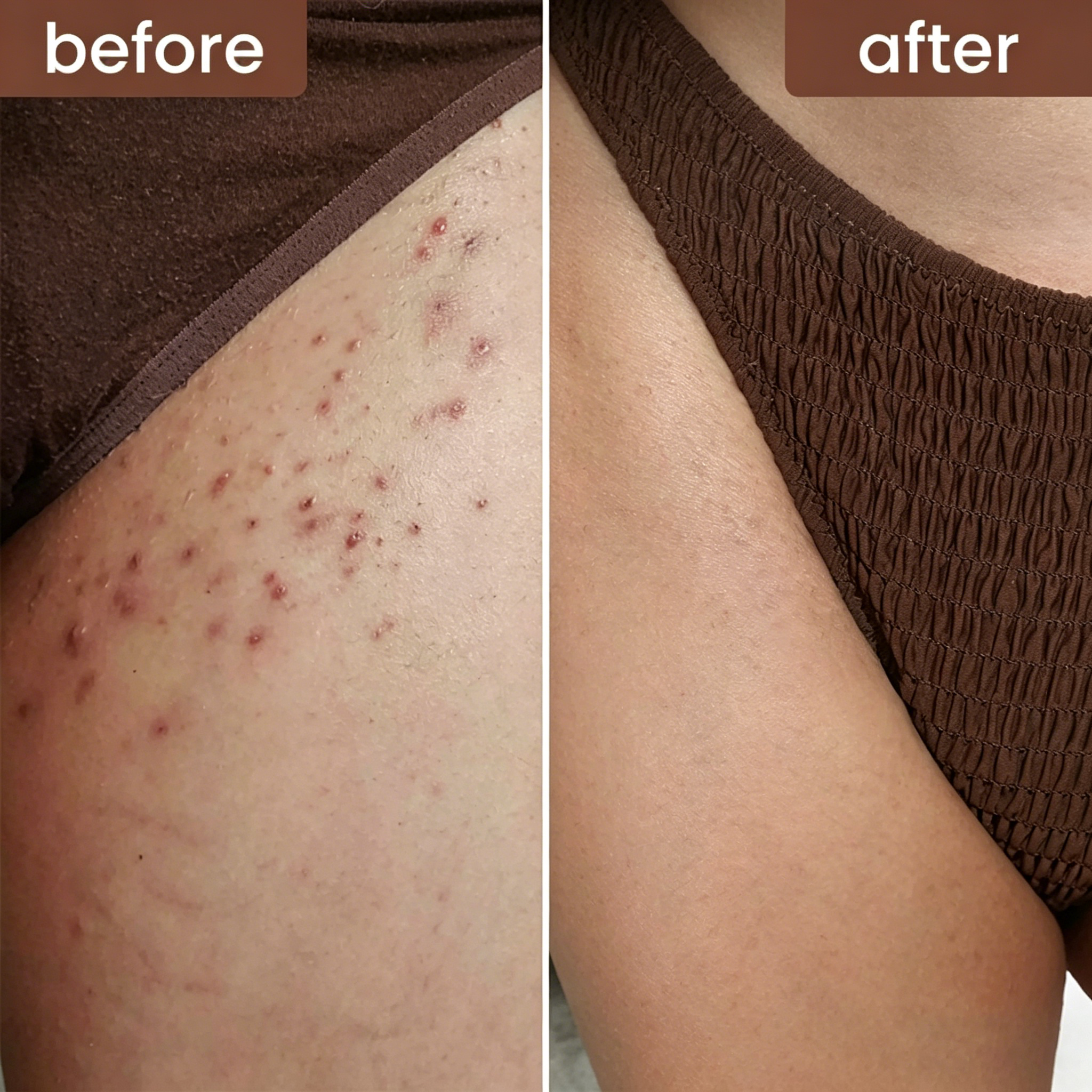 3-in-1 Bikini Line Care Serum