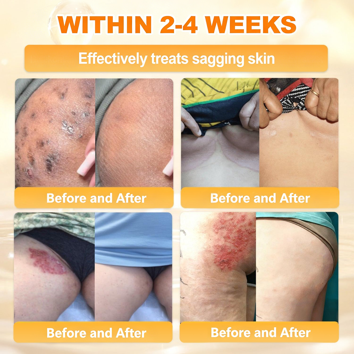 𝐋𝐎𝐕𝐈𝐋𝐃𝐒™ 𝐁𝐞𝐞 𝐏𝐨𝐢𝐬𝐨𝐧 𝐀𝐥𝐥-𝐢𝐧-𝐎𝐧𝐞 𝐂𝐫𝐞𝐚𝐦–🌸 Anti-aging,Hydrating, Skin Repair, Even Tone, Acne and Dark Spot Treatment, Wart and Mole Removal, Psoriasis Relief