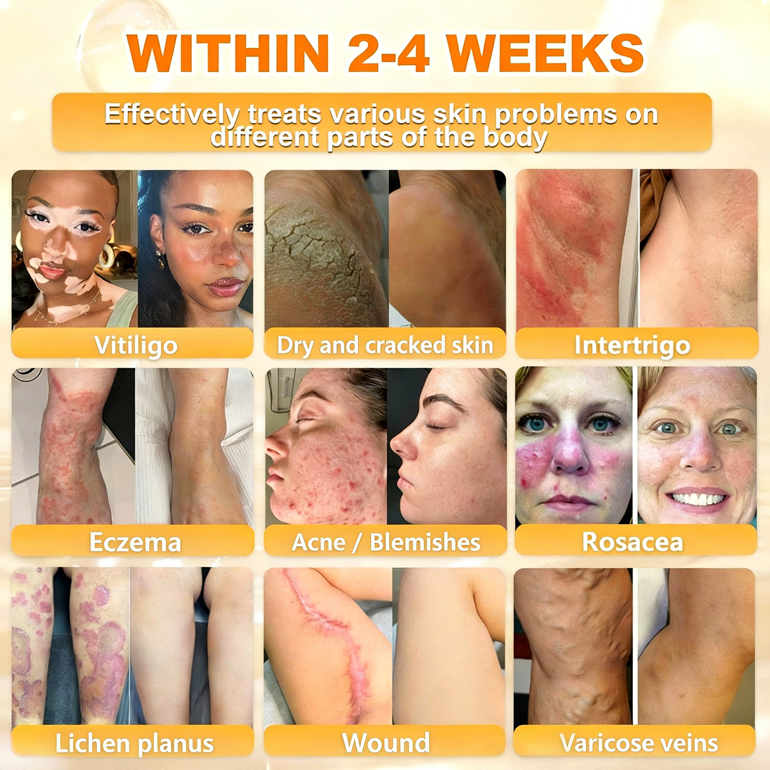 𝐋𝐎𝐕𝐈𝐋𝐃𝐒™ 𝐁𝐞𝐞 𝐏𝐨𝐢𝐬𝐨𝐧 𝐀𝐥𝐥-𝐢𝐧-𝐎𝐧𝐞 𝐂𝐫𝐞𝐚𝐦–🌸 Anti-aging,Hydrating, Skin Repair, Even Tone, Acne and Dark Spot Treatment, Wart and Mole Removal, Psoriasis Relief