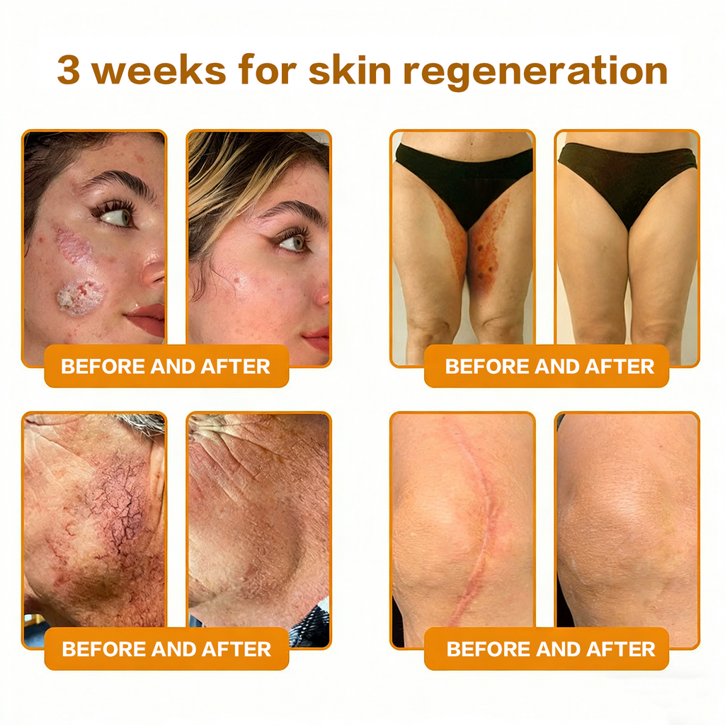 𝐋𝐎𝐕𝐈𝐋𝐃𝐒™ 𝐁𝐞𝐞 𝐏𝐨𝐢𝐬𝐨𝐧 𝐀𝐥𝐥-𝐢𝐧-𝐎𝐧𝐞 𝐂𝐫𝐞𝐚𝐦–🌸 Anti-aging,Hydrating, Skin Repair, Even Tone, Acne and Dark Spot Treatment, Wart and Mole Removal, Psoriasis Relief