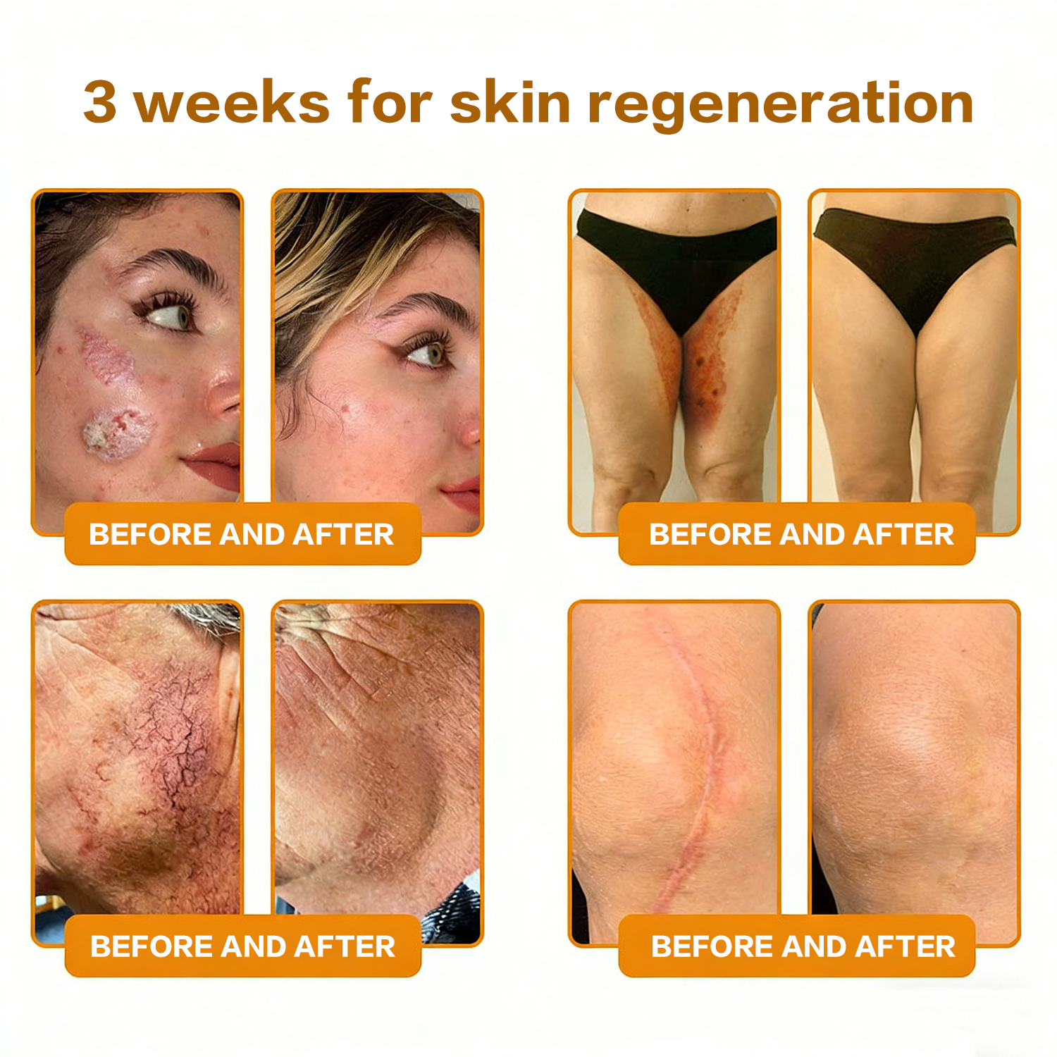 𝐋𝐎𝐕𝐈𝐋𝐃𝐒™ 𝐁𝐞𝐞 𝐏𝐨𝐢𝐬𝐨𝐧 𝐀𝐥𝐥-𝐢𝐧-𝐎𝐧𝐞 𝐂𝐫𝐞𝐚𝐦–🌸 Anti-aging,Hydrating, Skin Repair, Even Tone, Acne and Dark Spot Treatment, Wart and Mole Removal, Psoriasis Relief