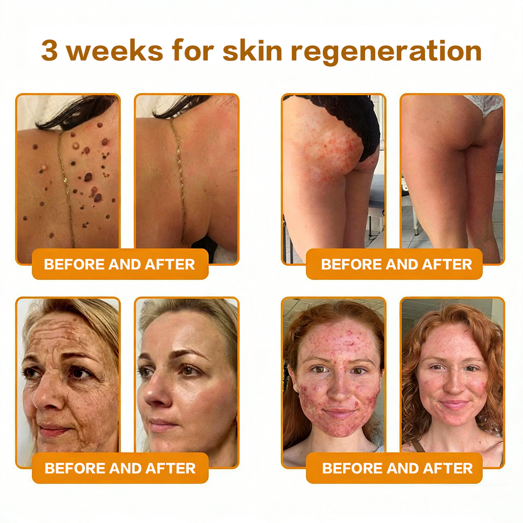 𝐋𝐎𝐕𝐈𝐋𝐃𝐒™ 𝐁𝐞𝐞 𝐏𝐨𝐢𝐬𝐨𝐧 𝐀𝐥𝐥-𝐢𝐧-𝐎𝐧𝐞 𝐂𝐫𝐞𝐚𝐦–🌸 Anti-aging,Hydrating, Skin Repair, Even Tone, Acne and Dark Spot Treatment, Wart and Mole Removal, Psoriasis Relief