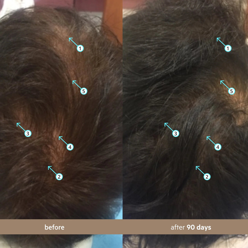 Spectral Men’s Nanoxidil 5% Hair Growth Serum for Thicker, Fuller Hair