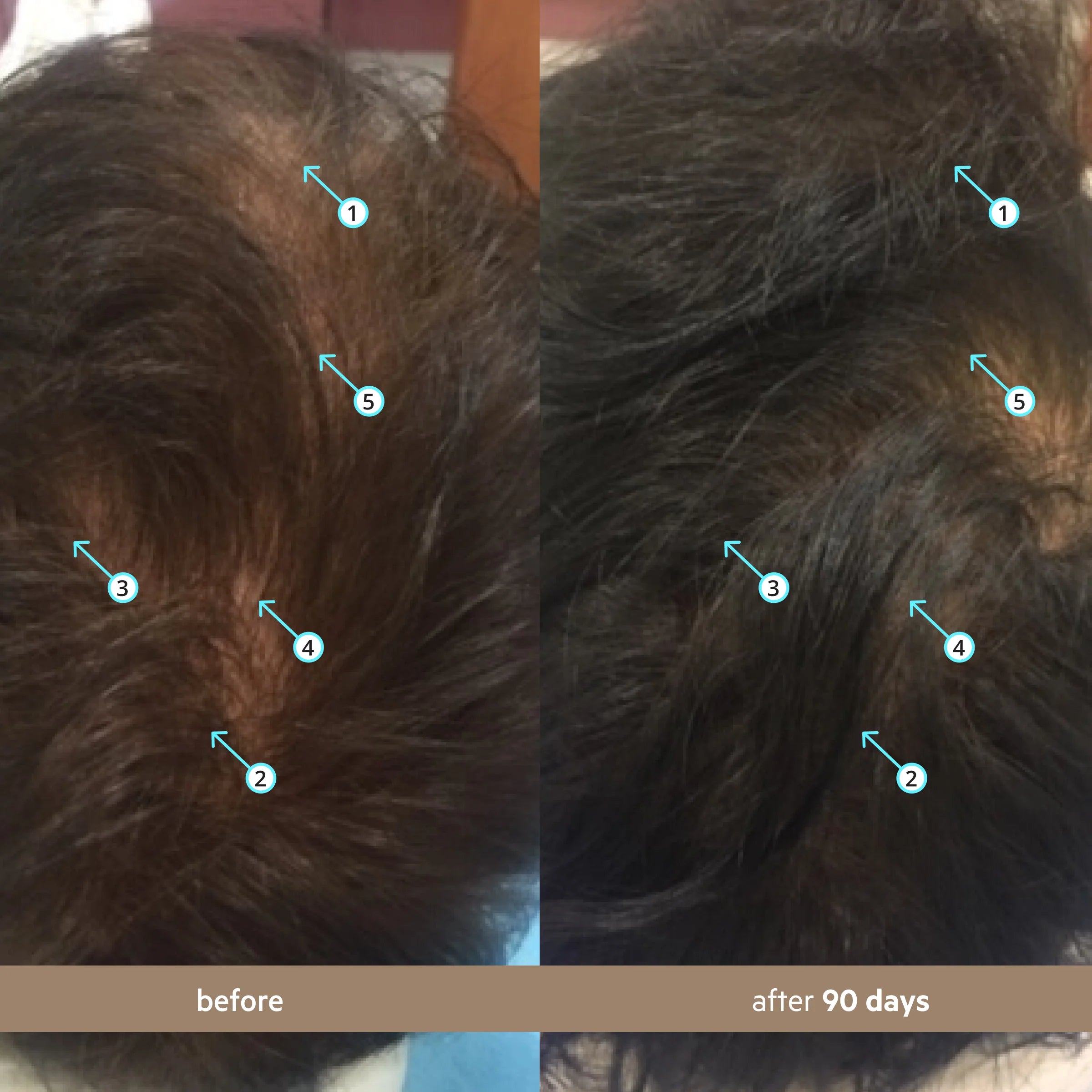 Spectral Men’s Nanoxidil 5% Hair Growth Serum for Thicker, Fuller Hair